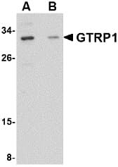 IHC-plus™ GRTP1 Antibody