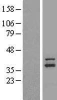 NDUFAF1 / CIA30 Protein (Over-Expression Lysate Myc-DDK (Flag))