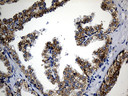 Monoclonal Mouse anti-Human CCDC22 Antibody (clone OTI5C1, IHC, WB)