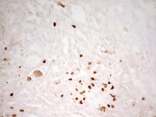 IHC-plus™ MNDA Antibody (aa37-321, clone 4H6)