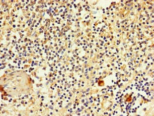 SLC2A3 / GLUT3 Antibody
