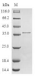 Human SMPX Protein (Recombinant GST, N-terminus)
