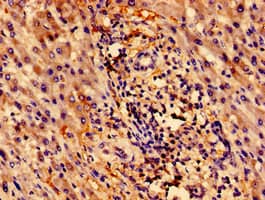 ZNF155 Antibody (aa1-538)
