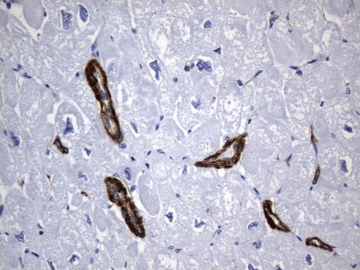 ACTA2 / Smooth Muscle Actin Antibody (N-Terminus, clone UMAB237)