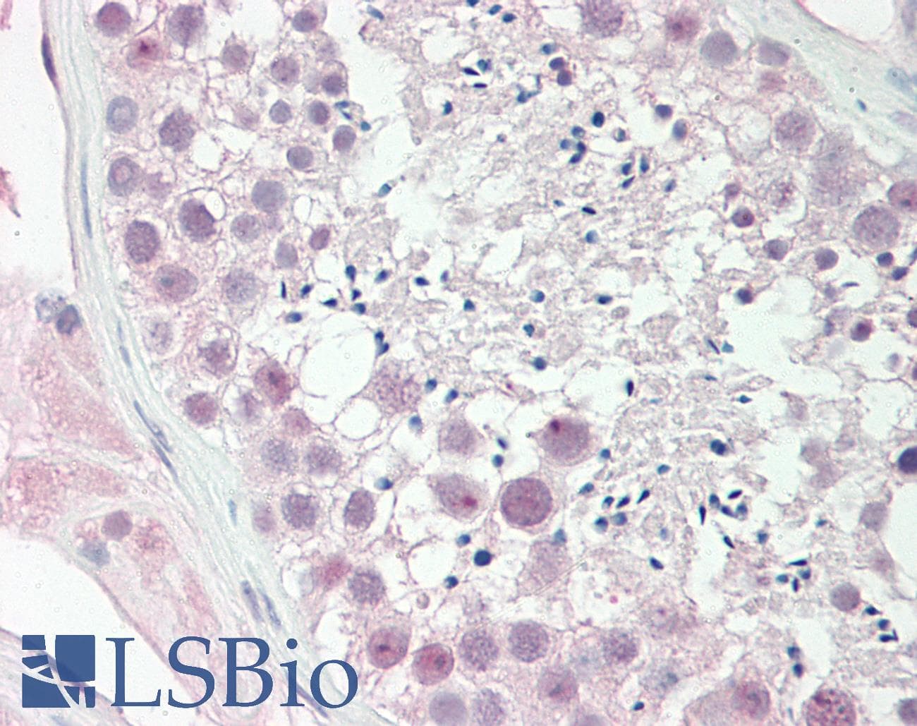 CITED1 Antibody (aa69-118)