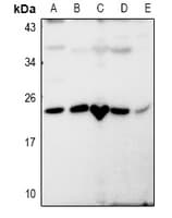 RASL10B Antibody