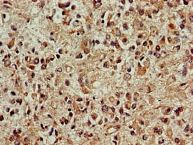 DCK / Deoxycytidine kinase Antibody