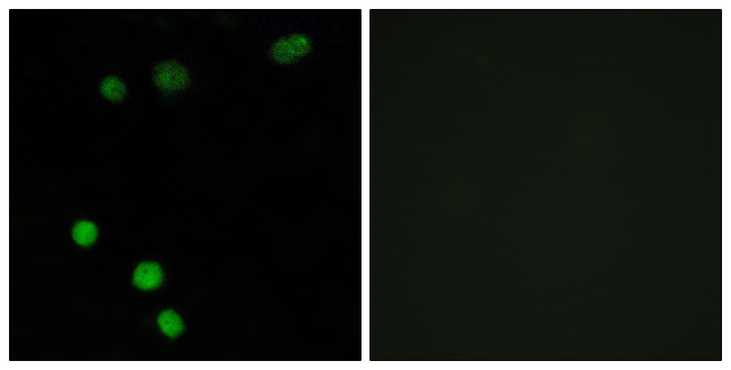 TP53INP2 Antibody (aa1-50)