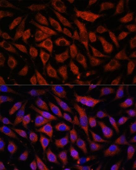 Polyclonal Rabbit anti-Human STK38L / NDR2 Antibody (IF)