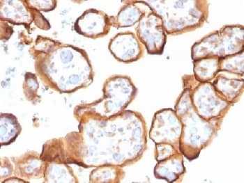Monoclonal Mouse anti-Human THBD / CD141 / Thrombomodulin Antibody (clone THBD/1591, IHC, IF, WB)