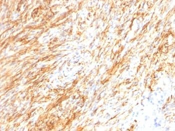GFAP Antibody (clone GA-5 + ASTRO/789)