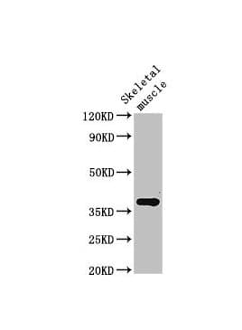 CTGF Antibody