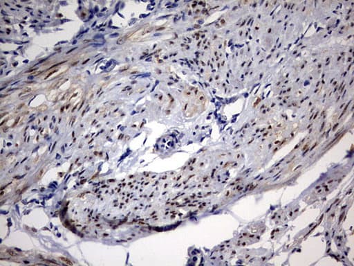 PR / Progesterone Receptor Antibody (aa1-298, clone OTI20A1)