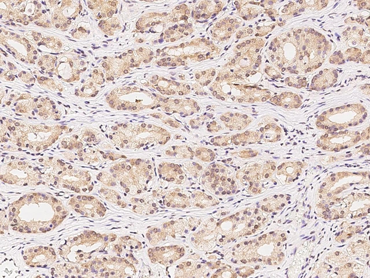 YWHAQ / 14-3-3 Theta Antibody