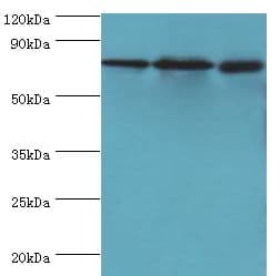 Polyclonal Rabbit anti-Human CXXC1 / CGBP Antibody (aa1-210, IHC, WB)