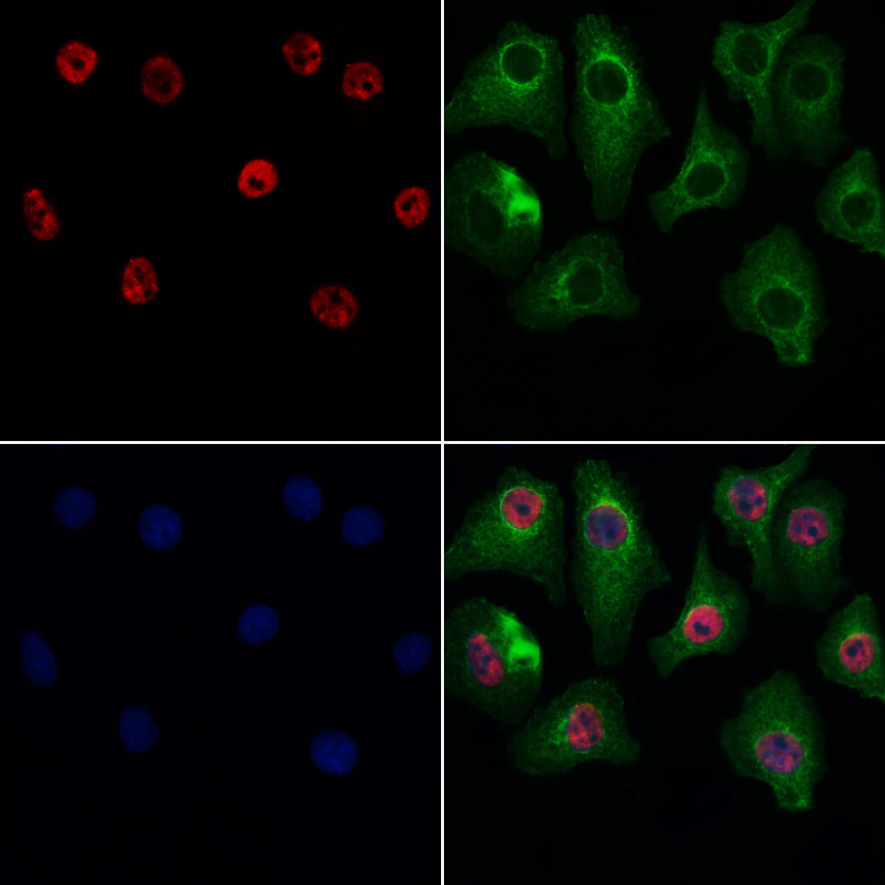 GSTO2 Antibody