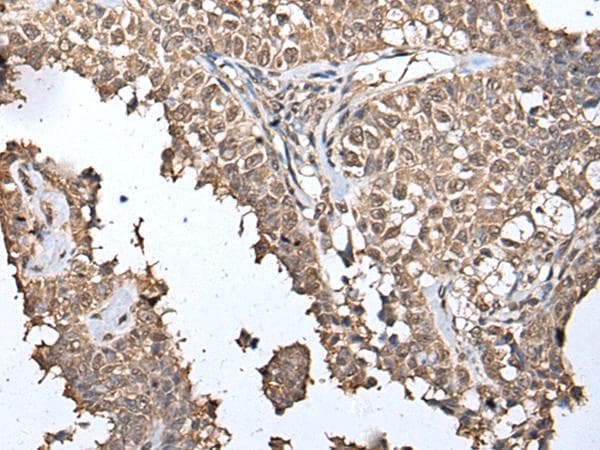MAP1D Antibody