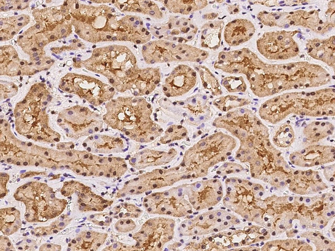 Polyclonal Rabbit anti-Human SMC4 Antibody (IHC)
