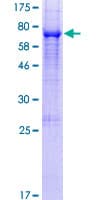 Human ENPP4 Protein (Recombinant GST)