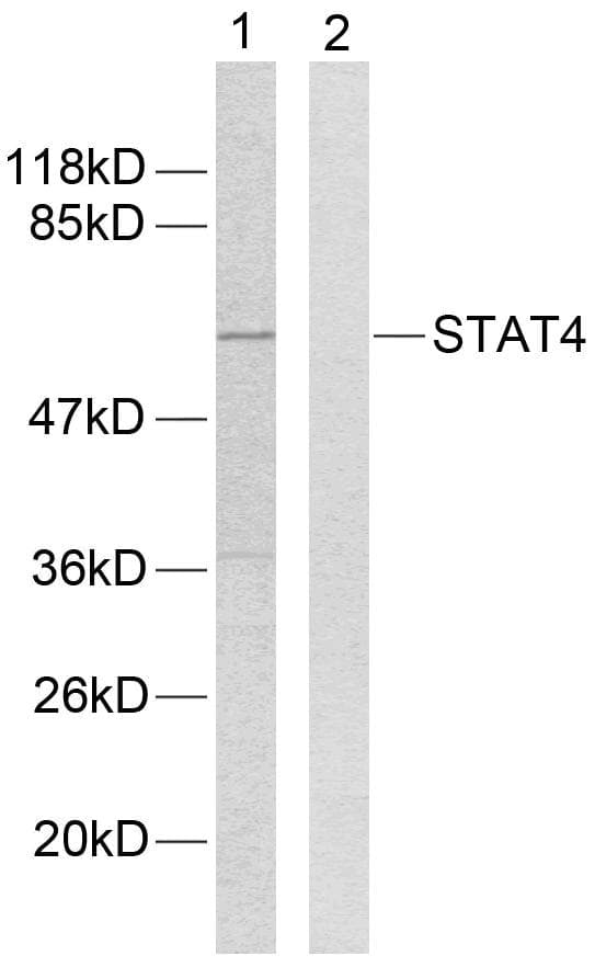 STAT4 Antibody (p693)