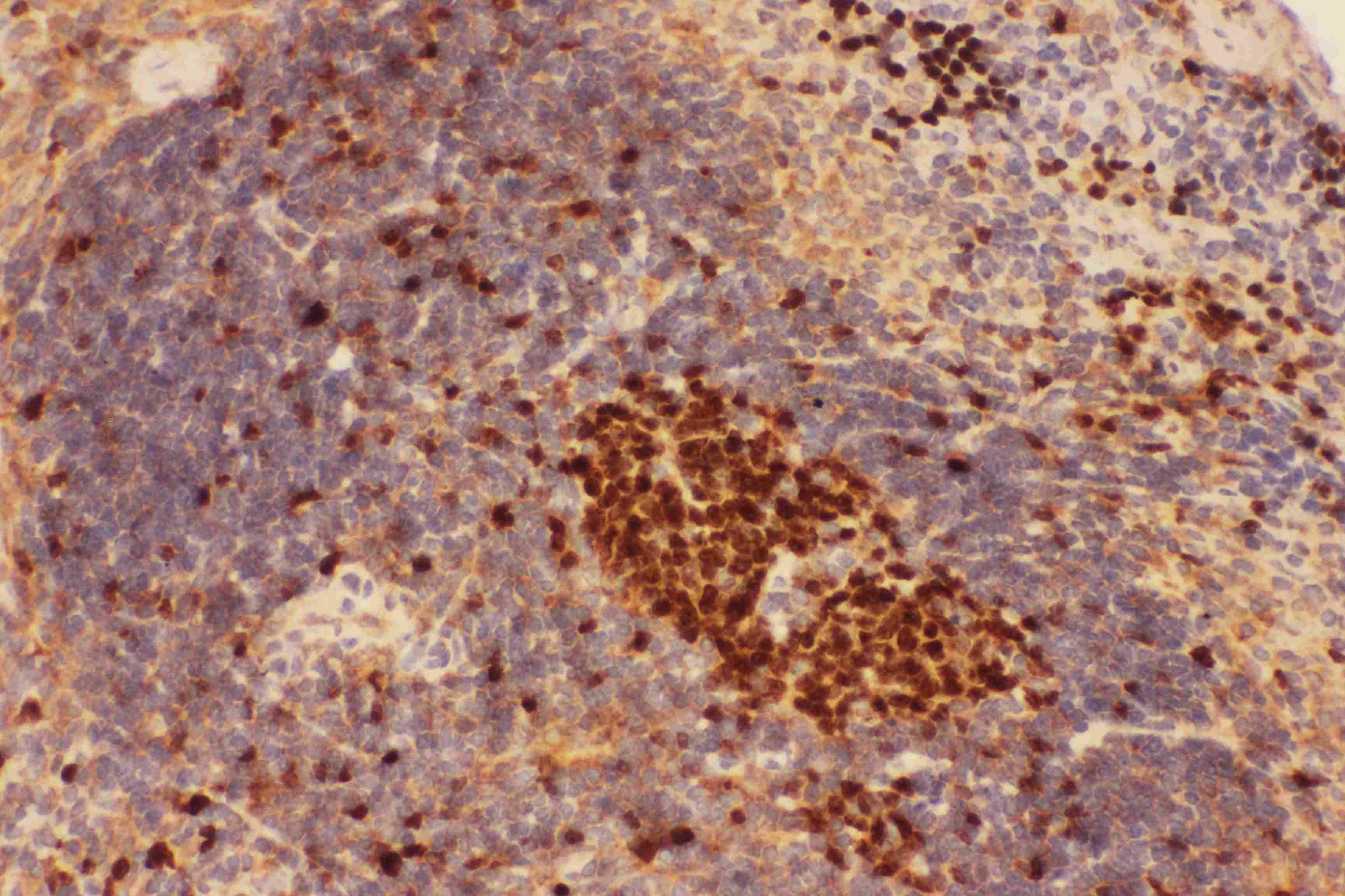 BECN1 / Beclin-1 Antibody (aa1-354)