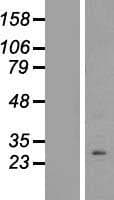 DPPL1 / PPAPDC1B Protein (Over-Expression Lysate Myc-DDK (Flag))
