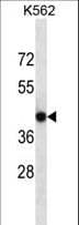 CACNG4 Antibody (aa147-175)