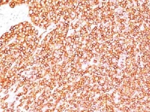 CD45 / LCA Antibody (clone SPM570)