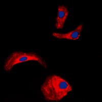 OLFML2A Antibody (Internal)