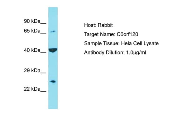 Polyclonal Rabbit anti-Human C6orf120 Antibody (C-Terminus, WB)