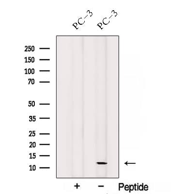 SPCS1 Antibody