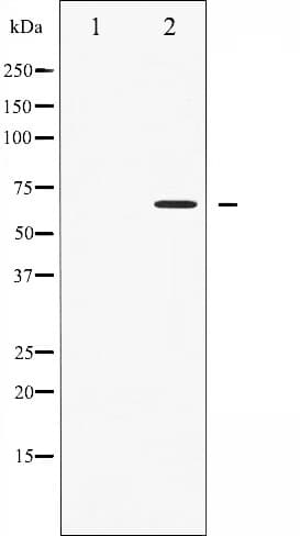 PRKAA1 / AMPK Alpha 1 Antibody (phospho-Thr172)