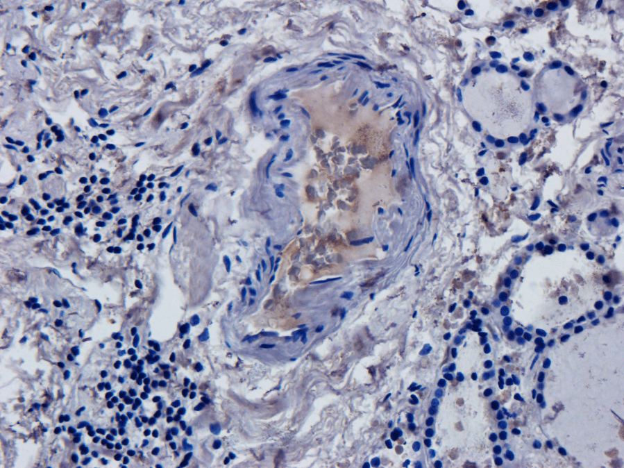 CD52 Antibody (CD52, clone Campath-1H)