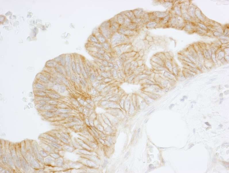 SPTAN1 / Alpha Fodrin Antibody (aa2422-2472)