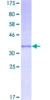 Human CCL2 / MCP1 Protein (Recombinant GST)