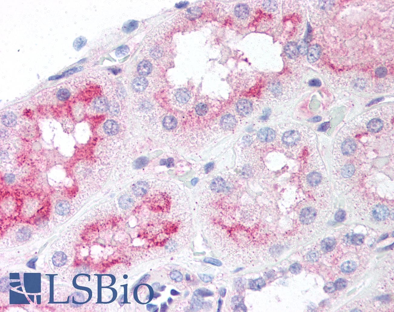 IHC-plus™ MTOR Antibody (phospho-Ser2448)