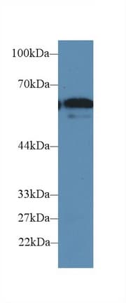 FUT4 / CD15 Antibody (aa144-389)