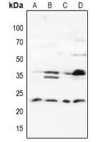 CMT2 / MAD2L1BP Antibody