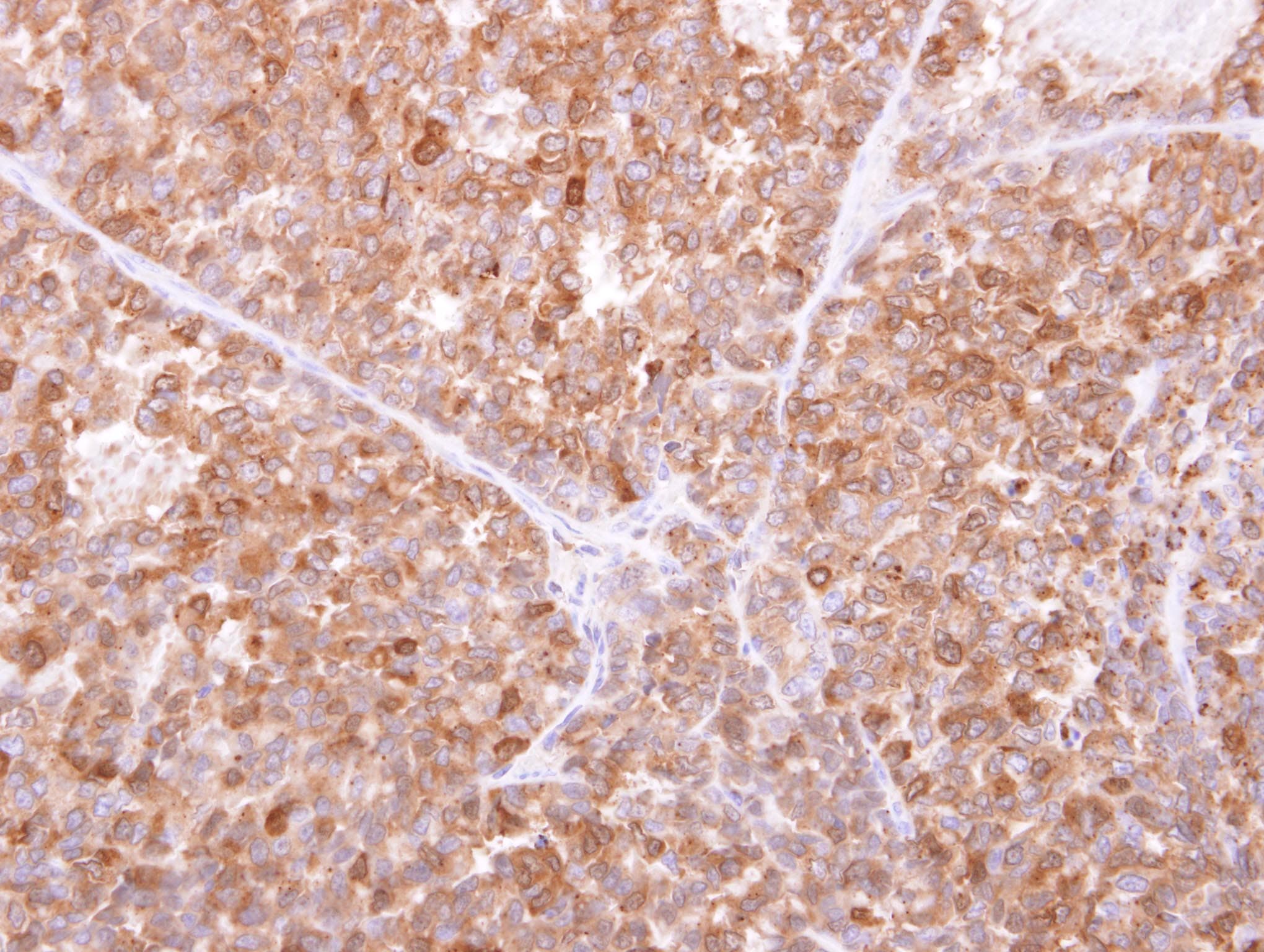 IFI30 / IP30 Antibody (aa14-250)