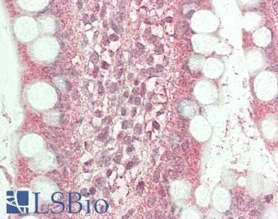 IHC-plus™ CACNB2 Antibody (clone 6C1)