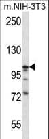 DAG1 / Dystroglycan Antibody (aa718-747)