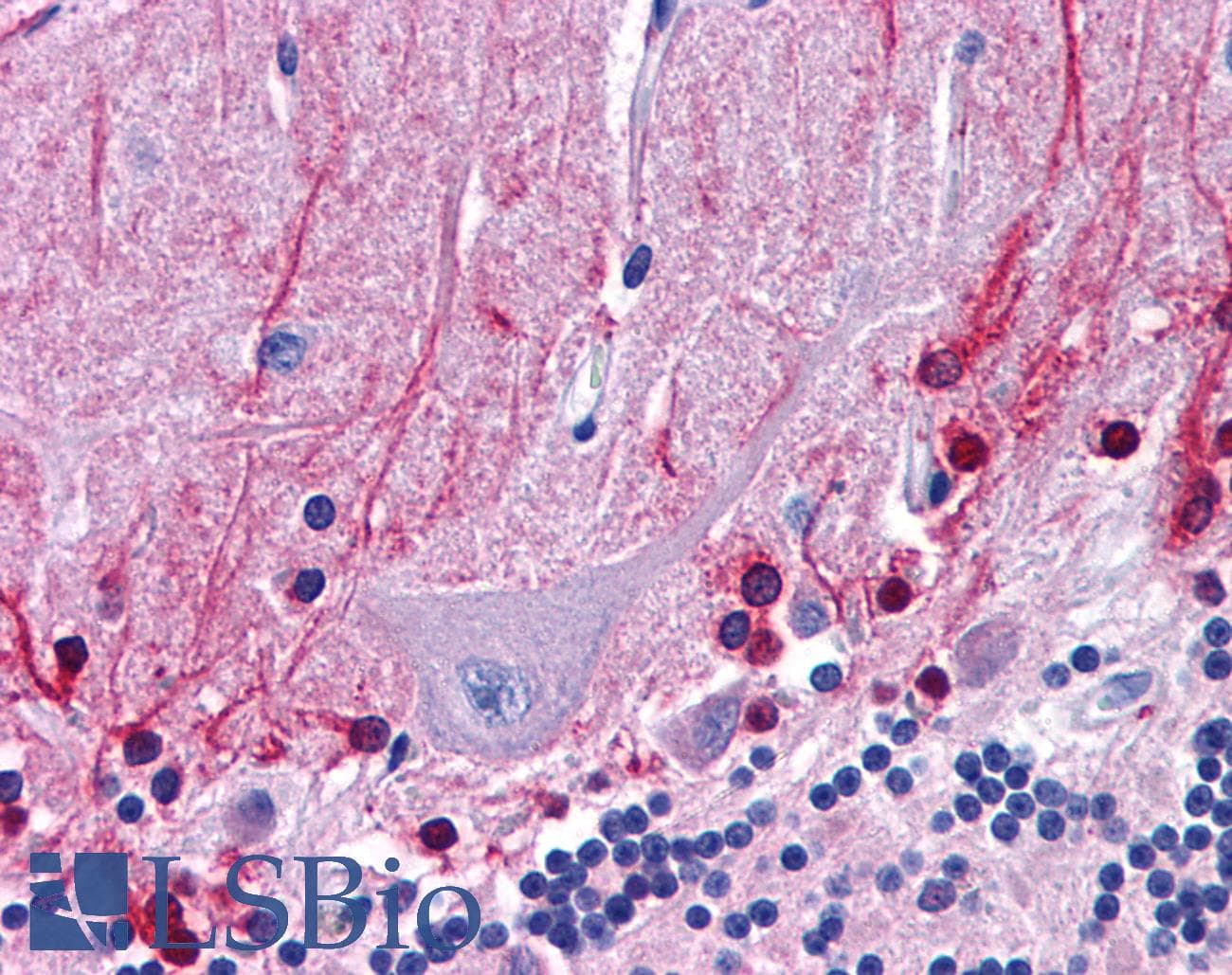 LIN28A / LIN28 Antibody