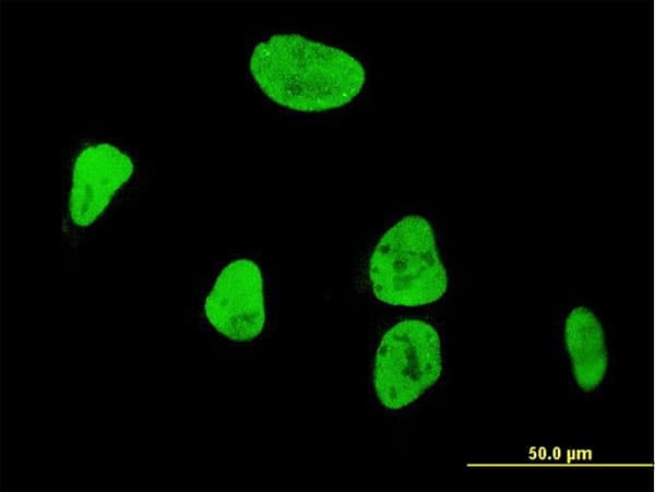 IHC-plus™ AML1 / RUNX1 Antibody (clone 3A1)