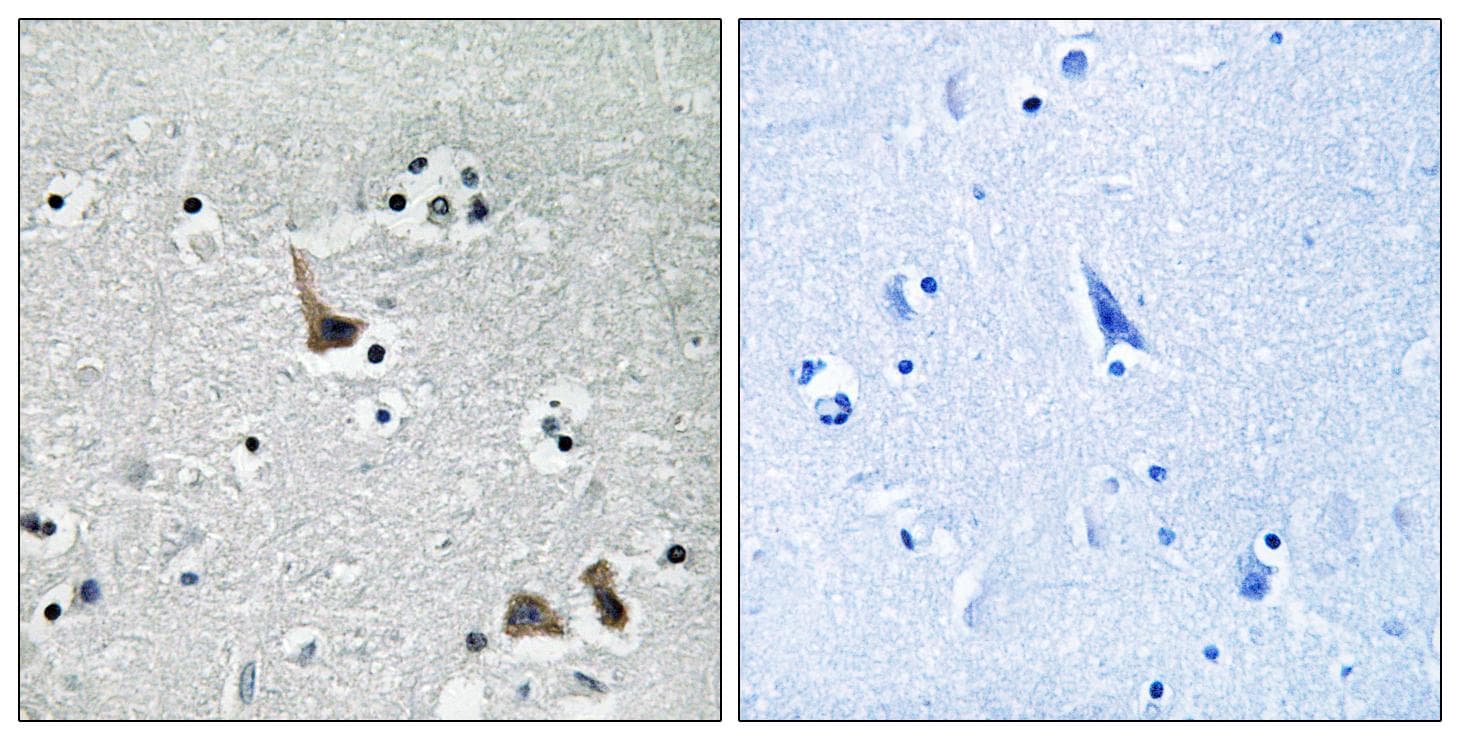 ATP6V1H Antibody