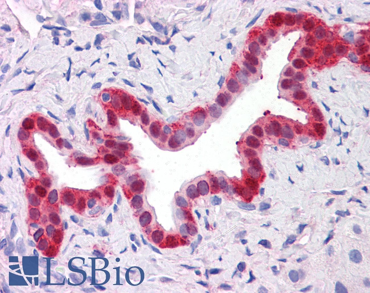 IHC-plus™ Monoclonal Mouse anti-Human ANXA4 / Annexin IV Antibody (clone 1D3, IHC, WB)
