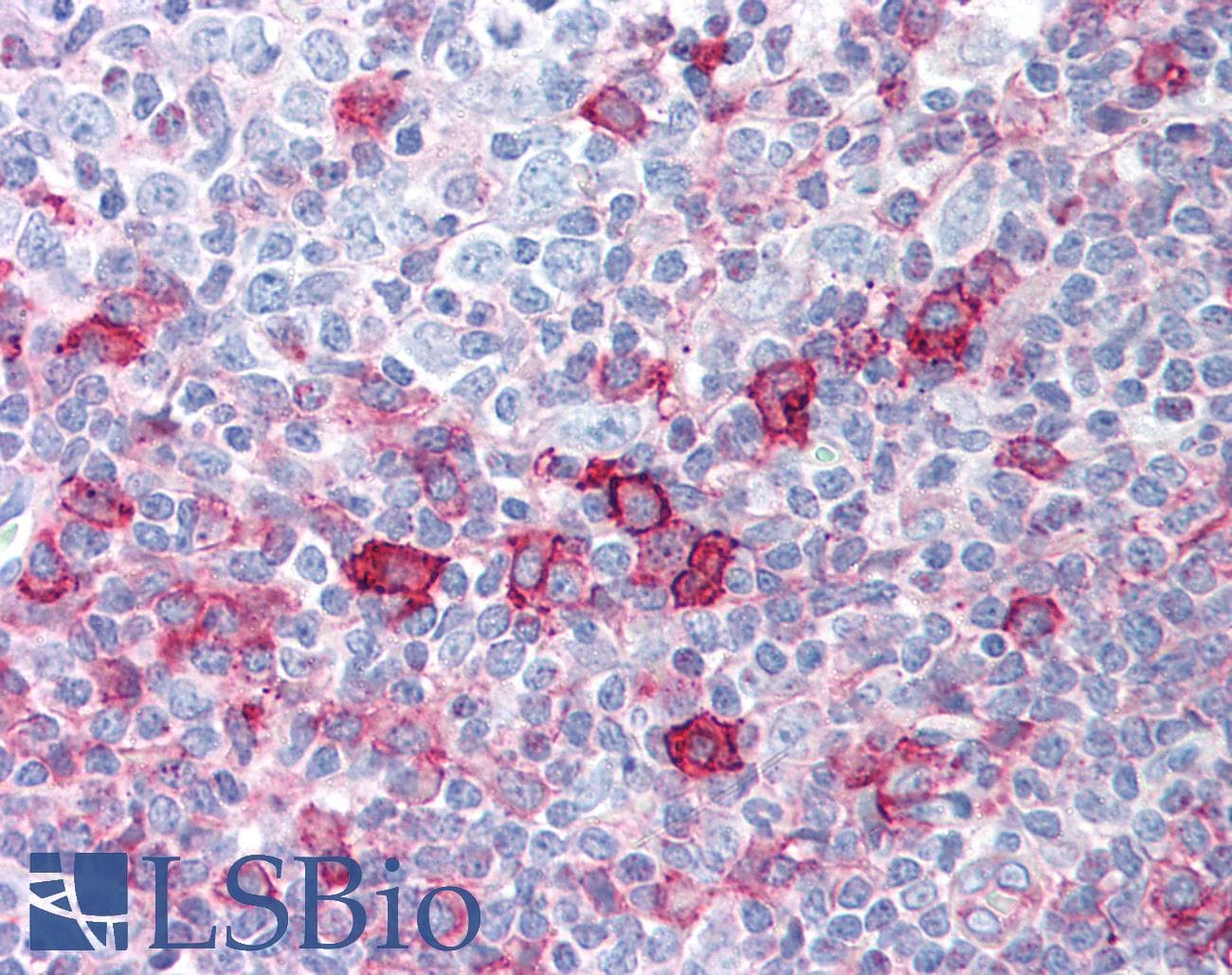 IHC-plus™ AKT1 + AKT2 + AKT3 Antibody (phospho-Ser473)