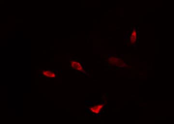 Polyclonal Rabbit anti-Human Requiem / DPF2 Antibody (IF, WB)