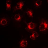 Polyclonal Rabbit anti-Human SLC20A2 / PIT2 Antibody (IF, WB)