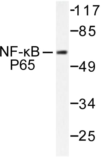 RELA / NFKB p65 Antibody (Gly530)