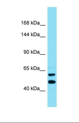 Polyclonal Rabbit anti-Human SOGA1 Antibody (aa94-143, WB)